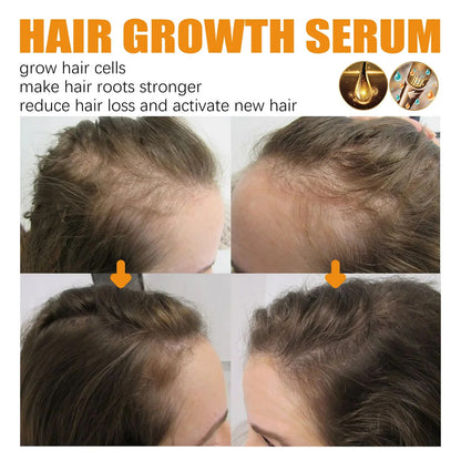 Biotin Hair Growth Spray