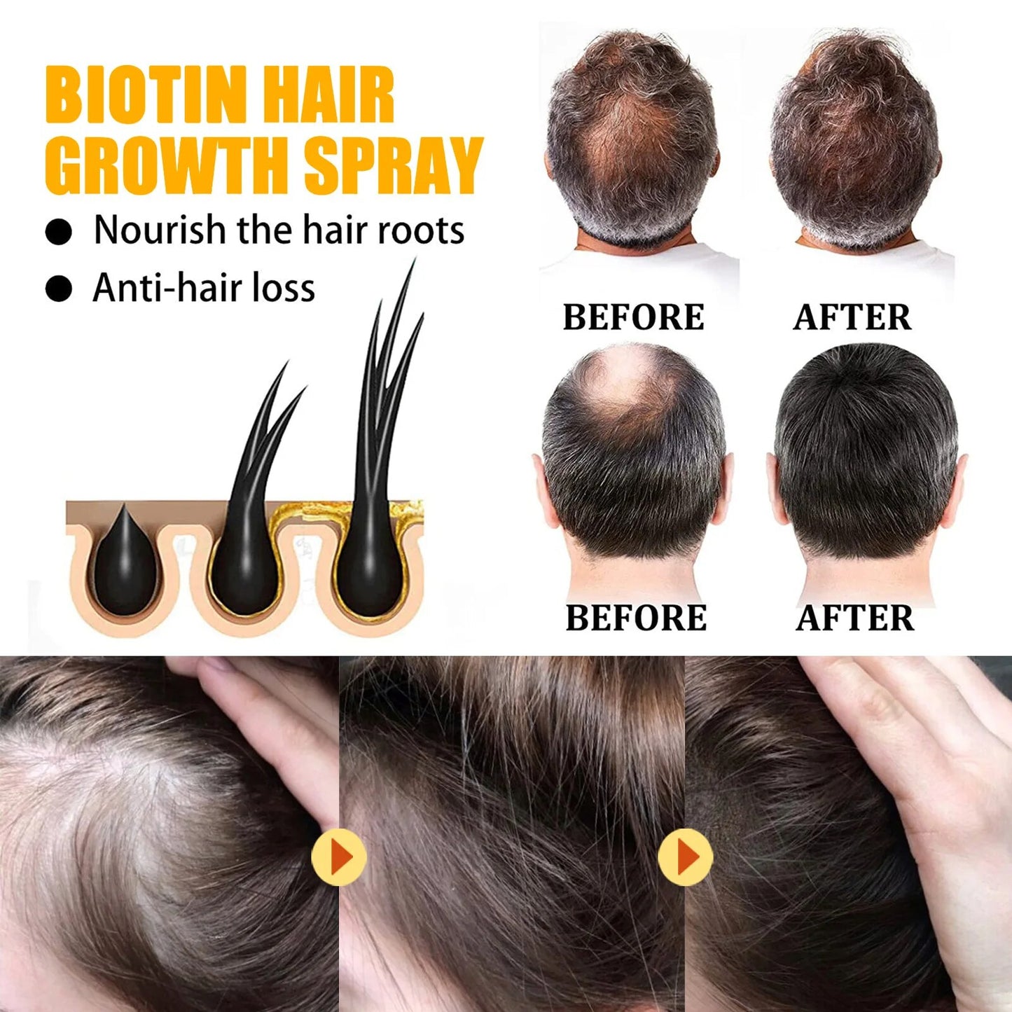 Biotin Hair Growth Spray